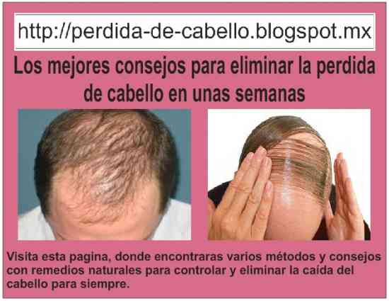 Tratamientos caseros para la caida del pelo Tratamientos caseros para la caida del pelo